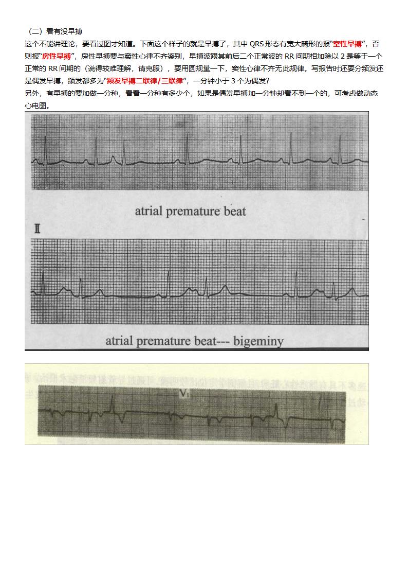 看了它就懂看心电图第2页