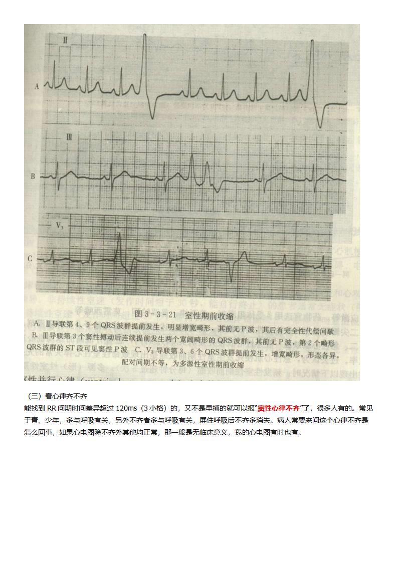 看了它就懂看心电图第3页