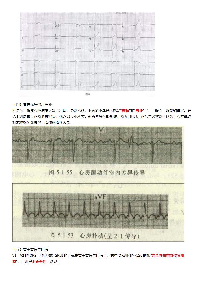 看了它就懂看心电图第4页