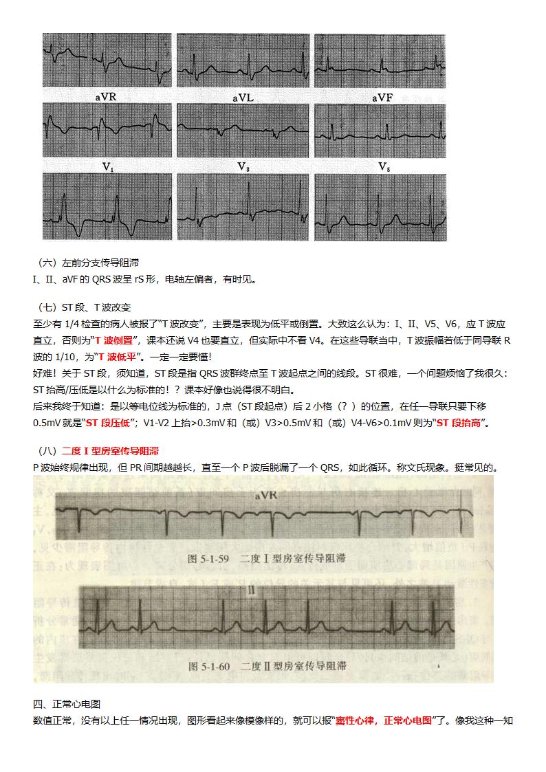 看了它就懂看心电图第5页