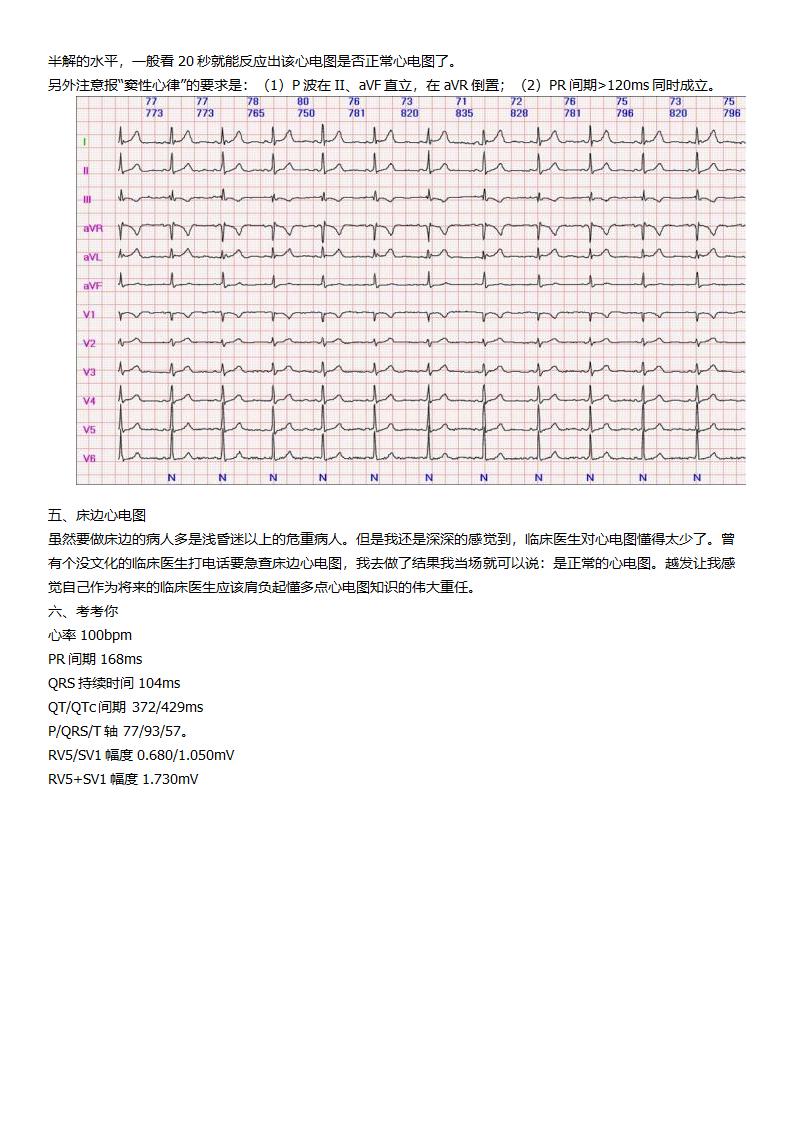 看了它就懂看心电图第6页