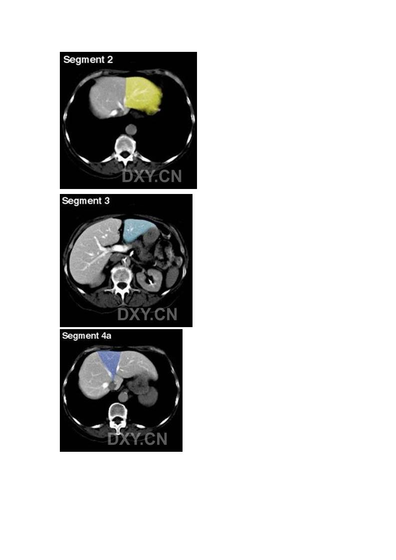 肝脏的CT分段第2页