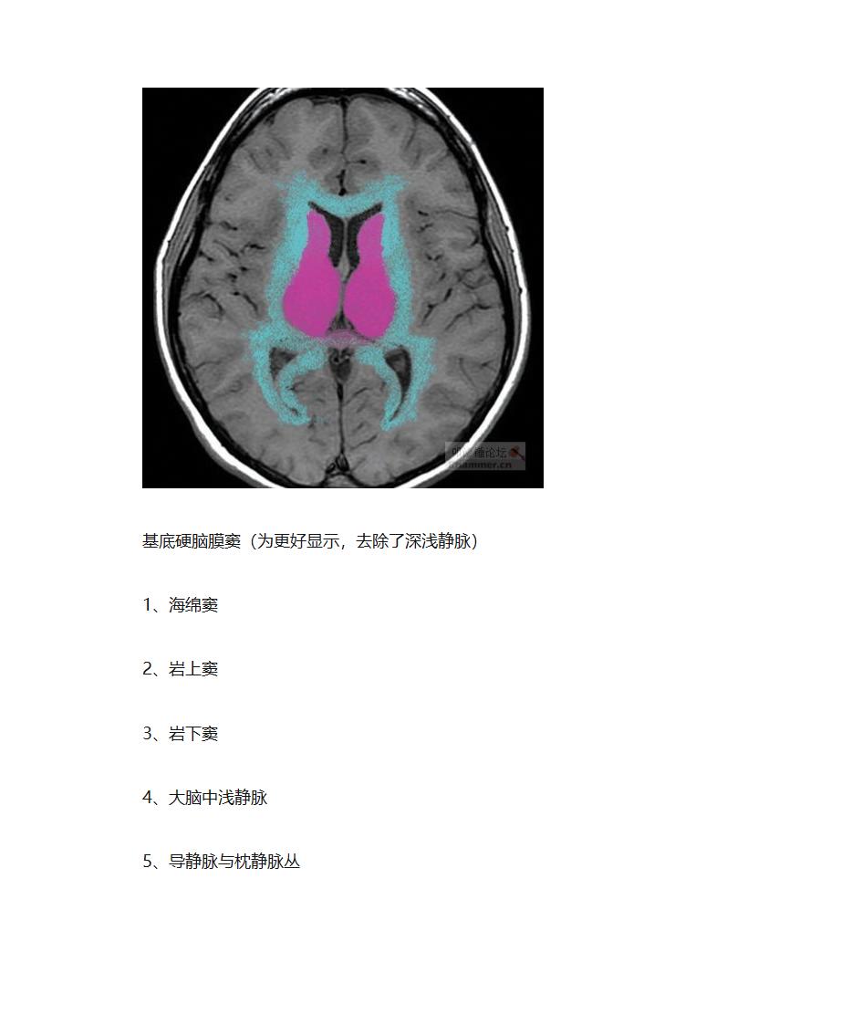 大脑血管解剖第6页