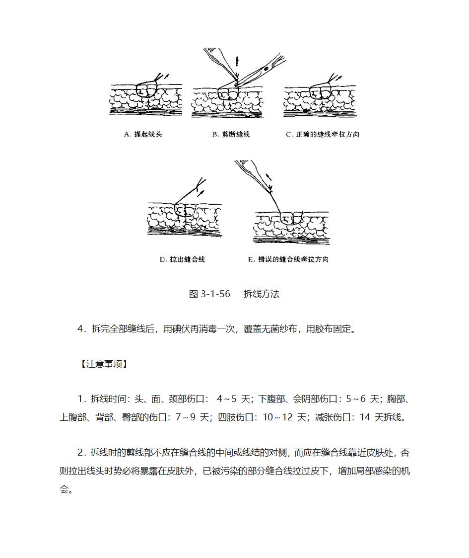 拆线技术第2页