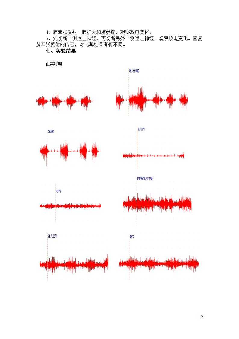 膈肌与膈神经的放电第2页