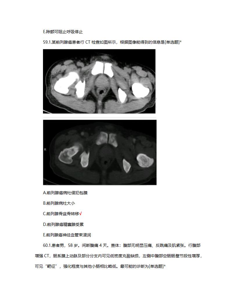 放射住培结业考试试题题库及答案第26页